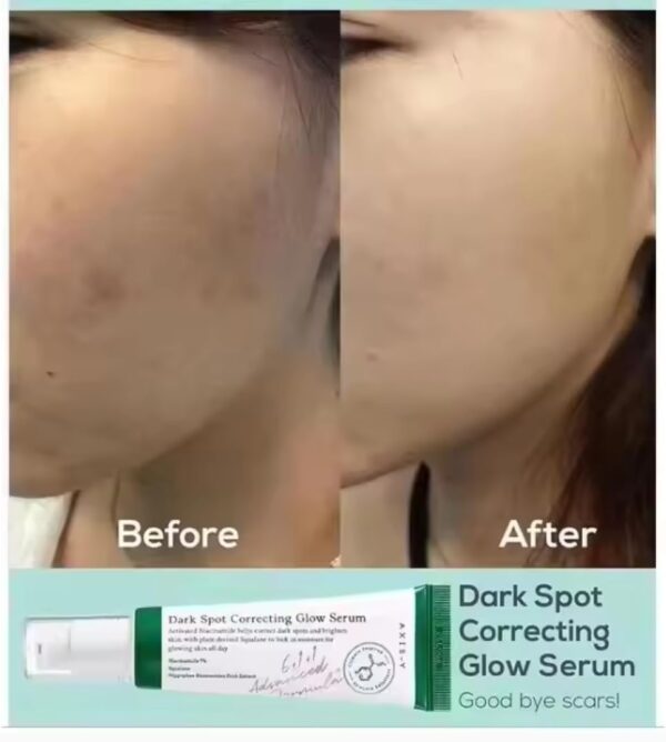 AXIS-Y - Dark Spot Correcting Glow Serum