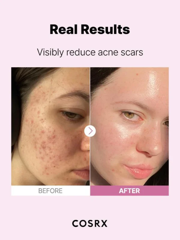 The Niacinamide 15 Serum - COSRX 3 The Niacinamide 15 Serum - COSRX